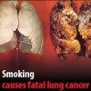 cancro polmoni fumo sigarette
