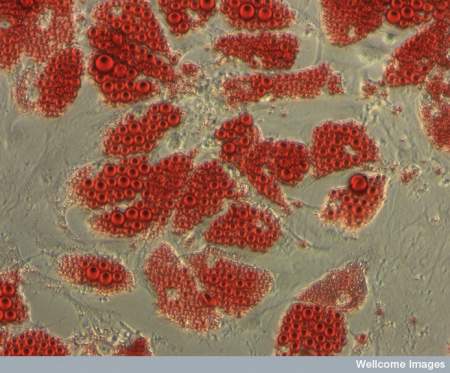 cellule staminali grasso adiposo