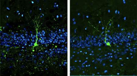 neurogenesi neuroni