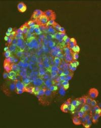 cellule staminali trapianti