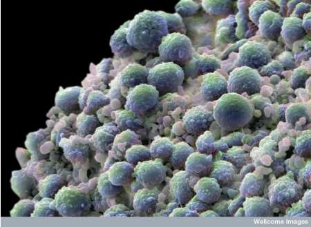 cellule staminali prostata cellule staminali prostata cancro