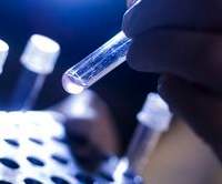 test progensa prostata