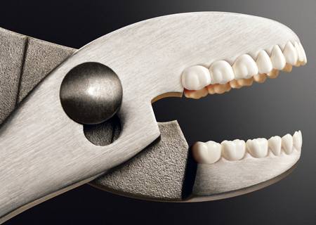 denti materiali