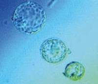 cellule staminali riprogrammate adulte