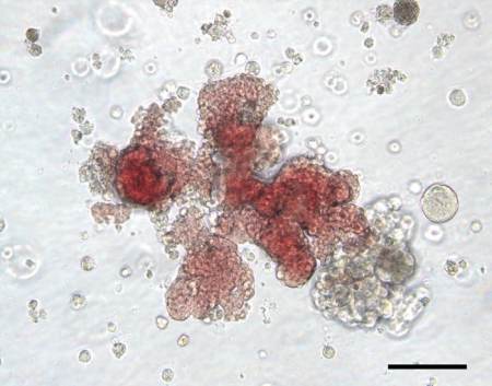 globuli rossi cellule staminali