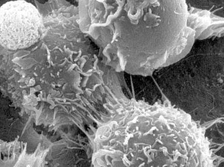 cellule staminali fegato fibrosi