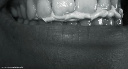 insulina orale insulina orale chewing gum