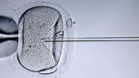 fecondazione in vitro fecondazione in vitro artificiale