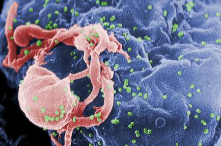 cellula hiv cellula hiv aids