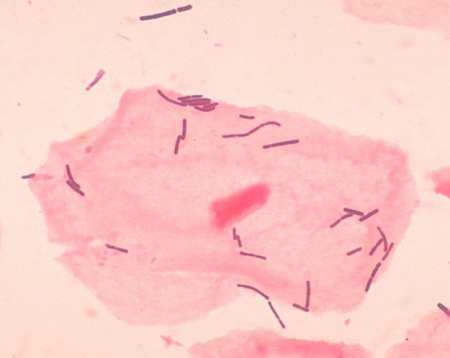 lactobacillus batteri latticini