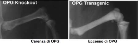 opg ossa osteoporosi