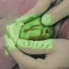 vene mano neonato