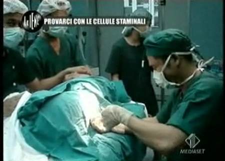 cellule staminali iene