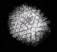 virus herpes cancro