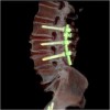 colonna vertebrale