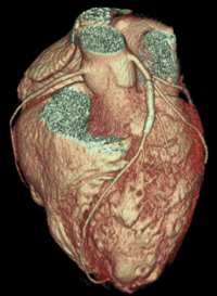 cuore staminali