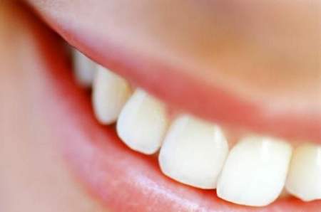 denti sorriso