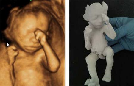 feto prototipazione rapida