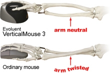vertical-mouse-3-1