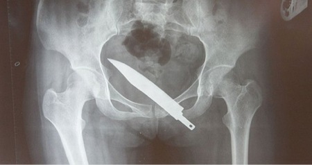 coltello1
