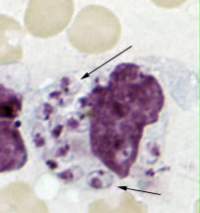 Leishmania donovani