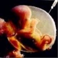 liquido amniotico feto