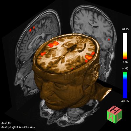 fmri risonanza magnetica funzionale cervello